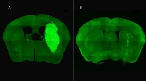 Izq. Se visualiza el tumor cerebral en un modelo preclínico. Der. El tumor desaparece gracias a la administración de la estrategia terapéutica diseñada por los especialistas (Imagen NA)