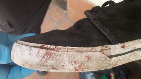 Fernando tenía una marca de 6 centímetros en el mentón producto de una patada