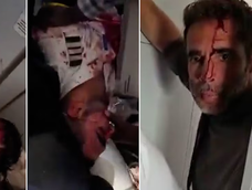 drama en un vuelo de flydubai: pasajeros grabaron a los pilotos heridos tras el violento episodio