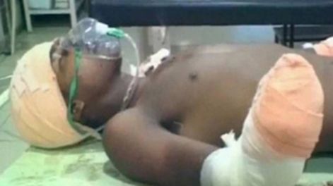 Un hombre le cortó las manos al violador de su beba