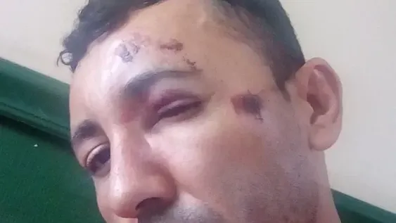 Paliza en un boliche: “El patovica me madrugó de atrás, me tiró al piso y me dio patadas”