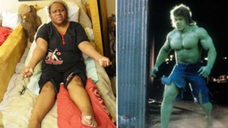 La Increíble Hulk