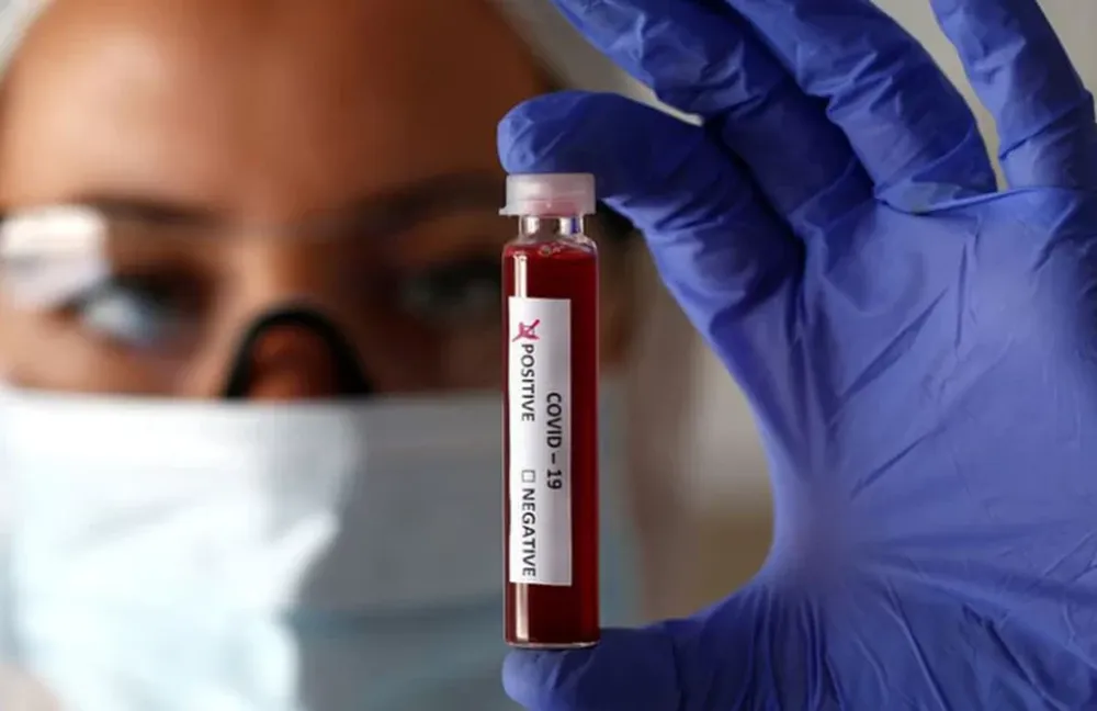 Alarmantes cifras en las últimas 24 horas en el país: 1.226 nuevos casos y 18 muertes por Covid-19