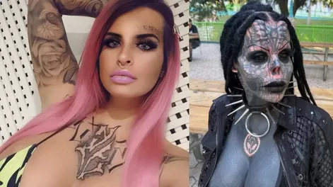 Se sometió a diversas cirugías para cambiar radicalmente su apariencia