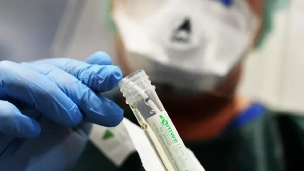 Argentina logró identificar la secuencia genética de al menos 388 cepas de coronavirus
