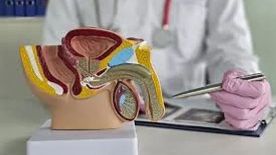 ES LEGAL Y GRATUITA  en Argentina. La vasectomía se realiza de manera ambulatoria y bajo anestesia local. No afecta la función sexual.