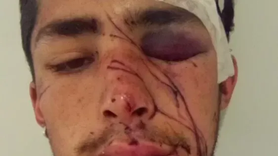 Se accidentó en moto y luego murió, hay bronca con el Hospital Rawson