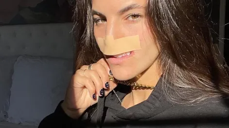 Una modelo mostró su reconstrucción facial luego de haber sido mordida por un perro