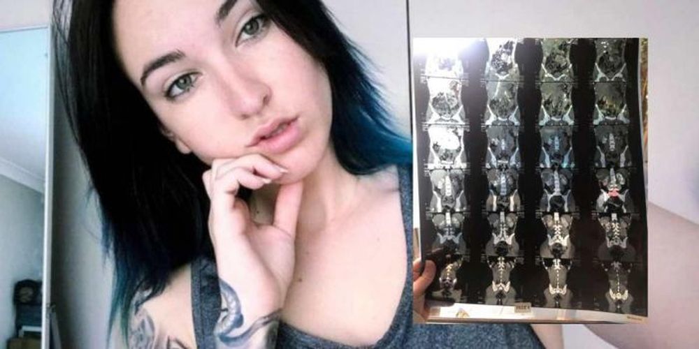 El extraño caso de la chica que tenía dos vaginas y pensaba que era normal