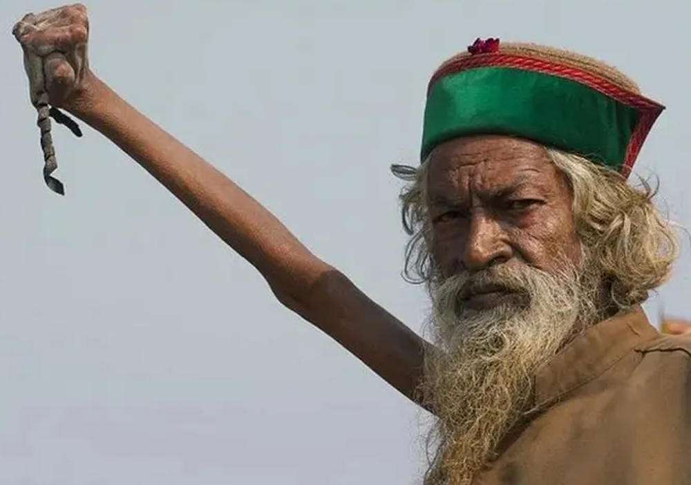 El impresionante caso del hombre que lleva 50 años con el brazo en alto