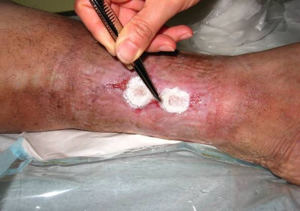 Generan cartílagos y piel para reparar  diferentes lesiones