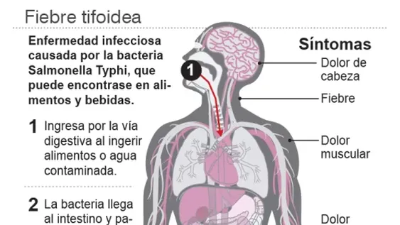 Alerta sanitaria por un brote de fiebre tifoidea en el AMBA