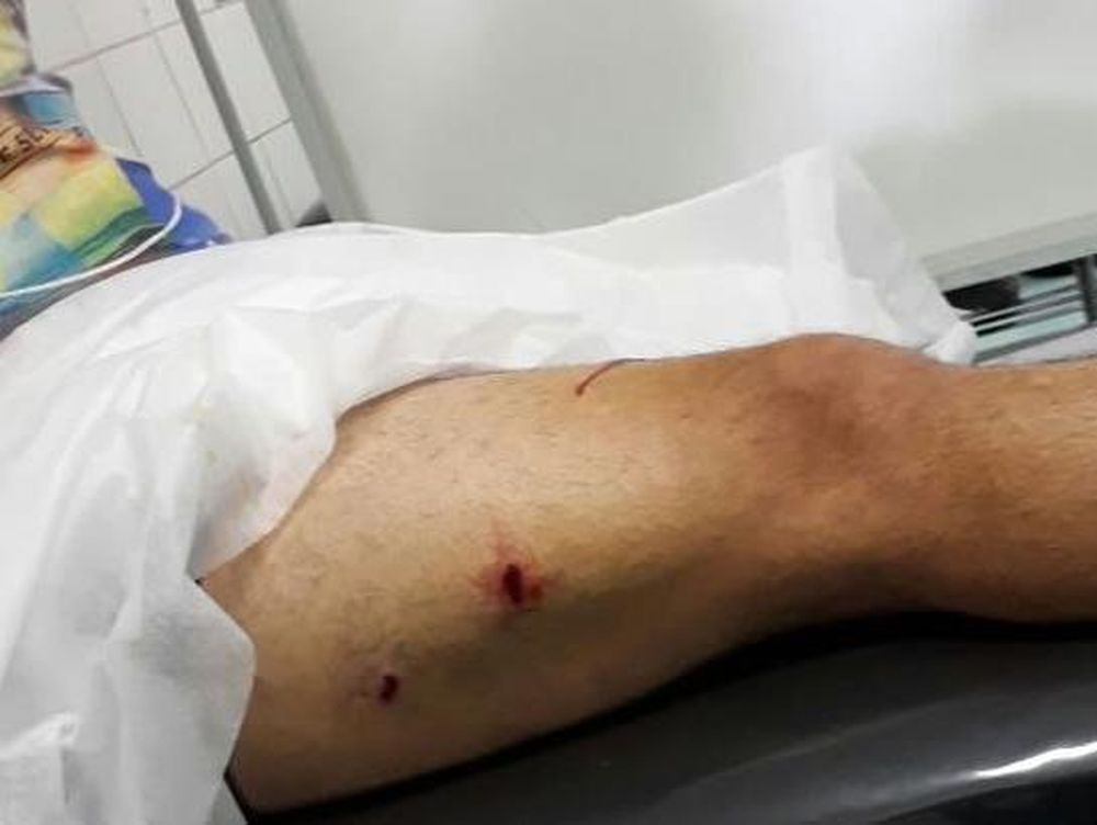 Dos delincuentes balearon a un hombre en una pierna para robarle la moto