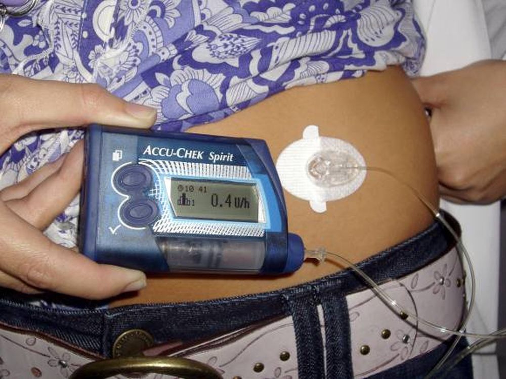 Diabetes infantil: un problema que crece y esperanzas que llegan