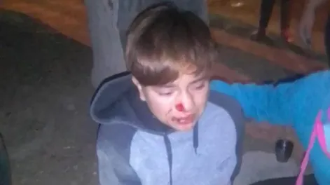 Atropellaron a una futbolista de Atenas cuando iba a comprar y escaparon sin asistirla