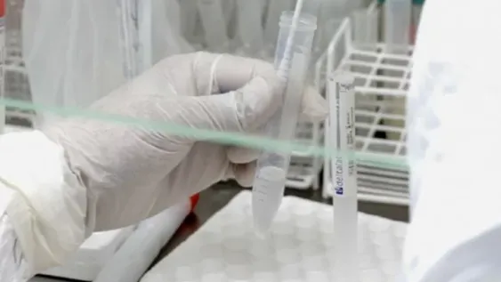 Prueban un aparato que permite tener mucho antes el resultado de los hisopados