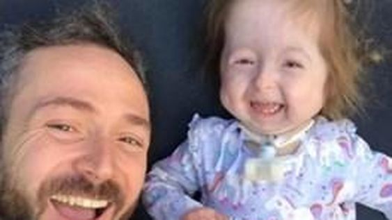 Tiene dos años pero parece anciana por la enfermedad de “Benjamín Button”