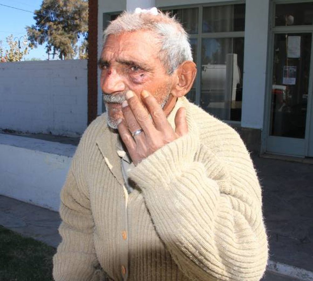 Atacan a ladrillazos a un  anciano y roban su pensión