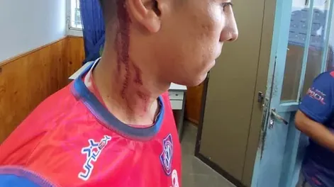 Violentos incidentes: jugadores de Villa Hipódromo fueron agredidos tras ganarle a Del Bono