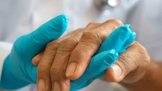 Aprobaron en Estados Unidos un nuevo tratamiento para el alzheimer