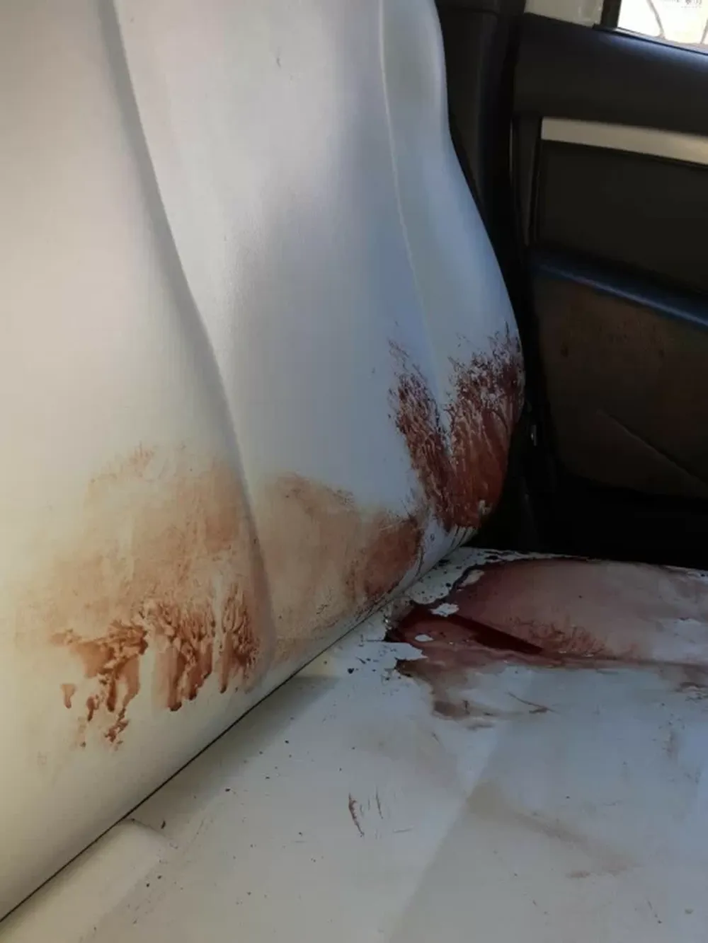 Agredía a su familia y uno de sus hermanos lo hirió fuertemente en la cabeza para calmarlo