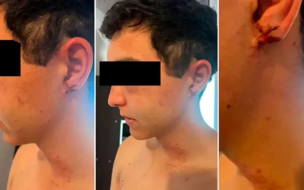 La gravísima denuncia de un trabajador rural torturado por sus jefes: “Me sacaron la oreja con los dientes”