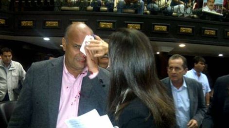 Golpean salvajemente a legisladores de Capriles