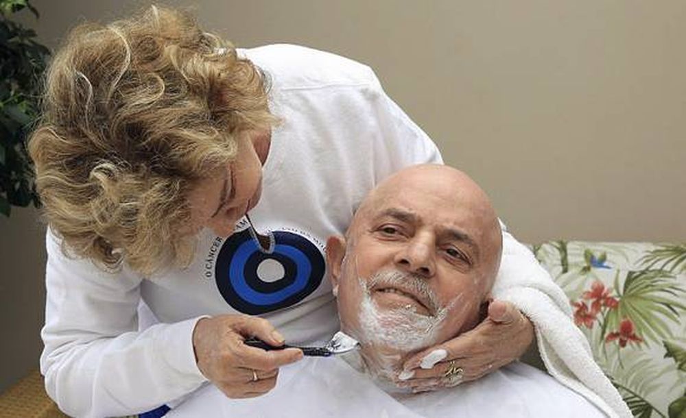 La pelada de Lula