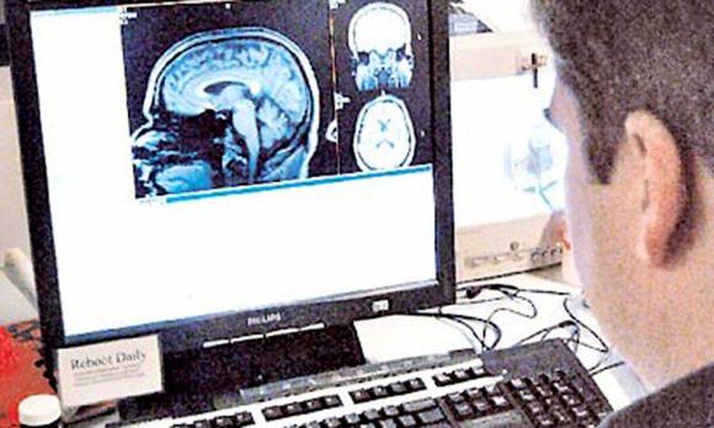 En estado vegetativo, se pudo comunicar con el pensamiento