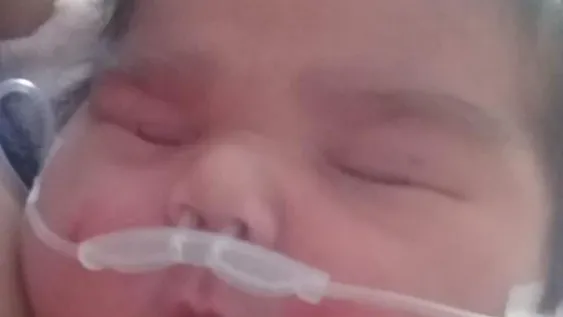 Mejora el estado de salud de Maicol, el “súper bebé” que nació con 5,650 Kg