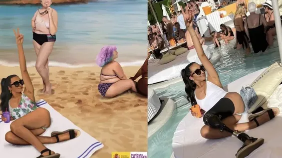 Un ministerio robó fotos de modelos para una campaña: a una le sacó su pierna ortopédica