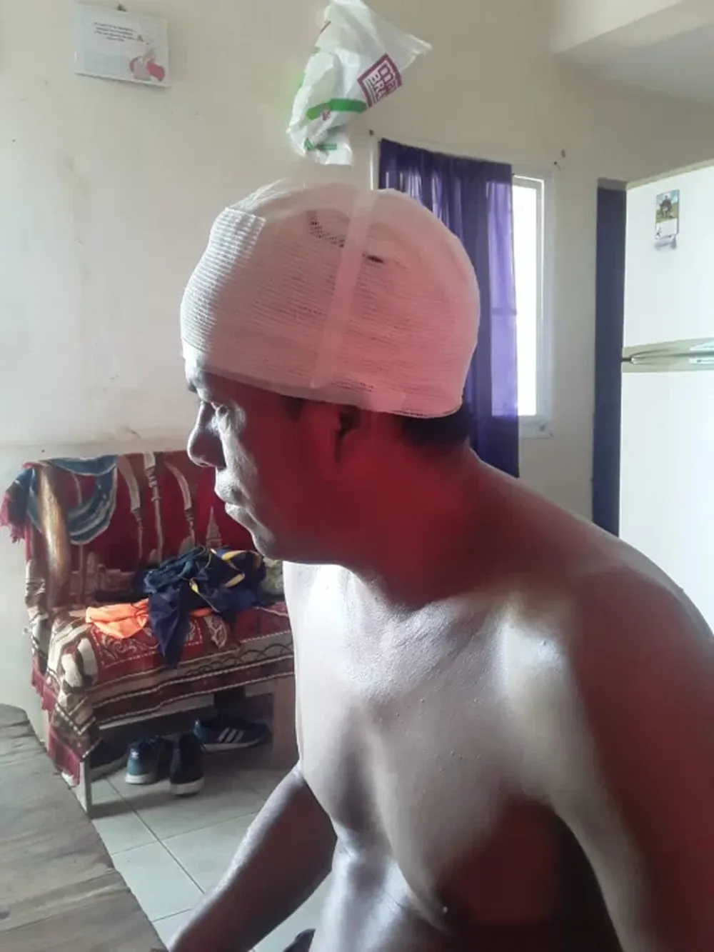 El hombre con la cabeza vendada.