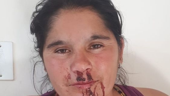 Llegó buscando a su expareja, la agarró a patadas en el lugar y terminó detenido