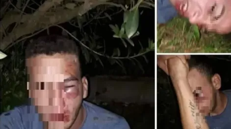 Pactó un encuentro con una chica y la familia de ella lo linchó: “Le pegaron como a un animal”