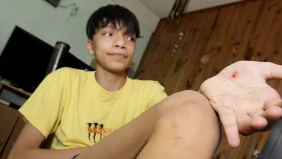 La misma jauría y en el mismo barrio atacó nuevamente a un adolescente