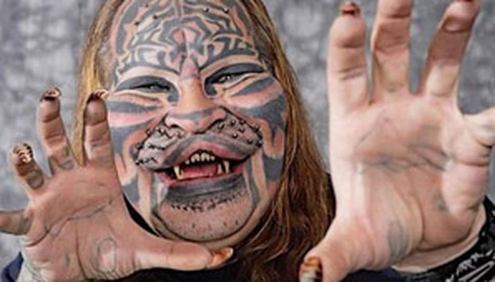 Murió el “hombre-gato”