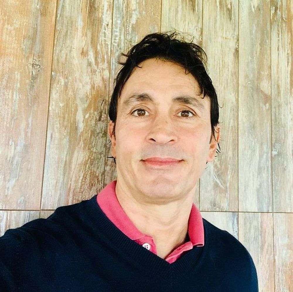 Sebastián Estevanez mostró por primera vez las fotos de su cara quemada