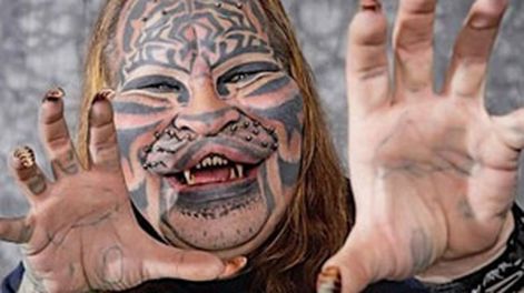 Murió el “hombre-gato”