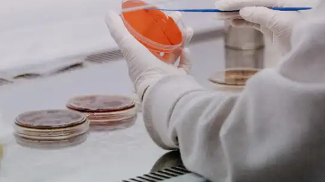 El primer análisis sobre la muestra de viruela del mono en el país dio positivo
