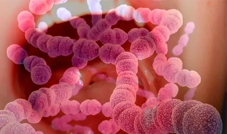 Cuáles son los síntomas de infección invasiva por Streptococcus pyogenes y cómo se trata