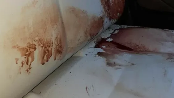 Agredía a su familia y uno de sus hermanos lo hirió fuertemente en la cabeza para calmarlo