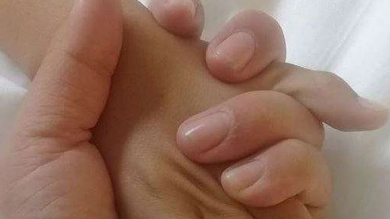 Dos casos de menores atacados por perros en menos de 7 horas: ambos tienen 13 años