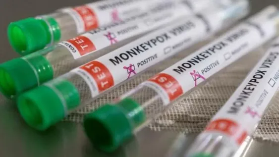 Confirmaron el primer caso de viruela del mono en Argentina