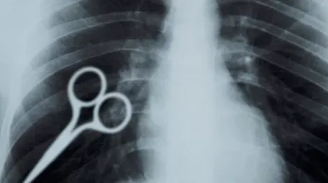 Un preso se tragó una tijera como acto de protesta y debió ser hospitalizado