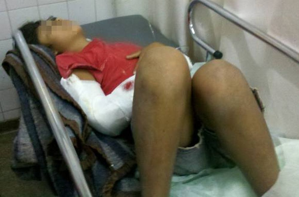 Cayó un poste de luz y casi  mató a una niña en Pocito