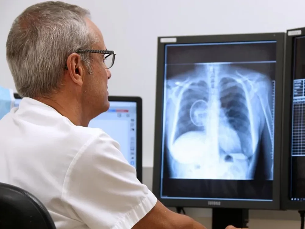 Fármaco reduce 34% la tasa de progresión del tipo de cáncer de pulmón más frecuente