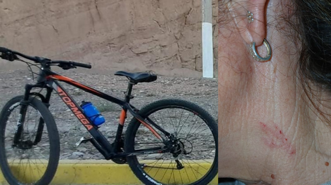 La bicicleta robada y cómo agredieron a la víctima.