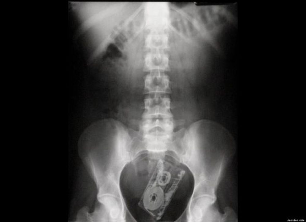 Radiografías insólitas