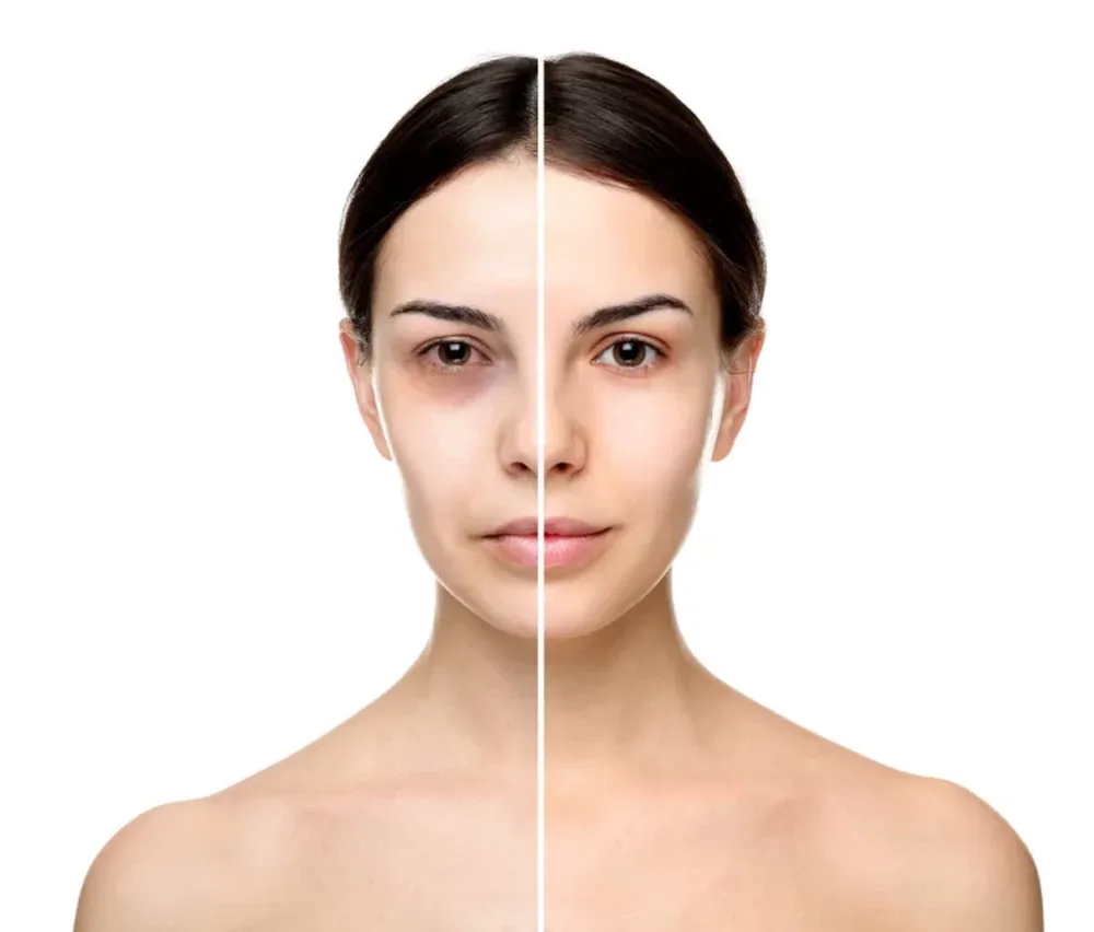 Cómo lucir una mirada brillante en 3 pasos: causas, prevención y tratamientos para las ojeras