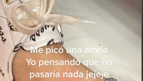 La picó una araña sobre un tatuaje y mostró cómo quedó su pierna luego de dos meses